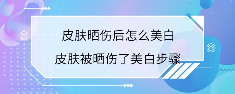 皮肤晒伤后怎么美白 皮肤被晒伤了美白步骤