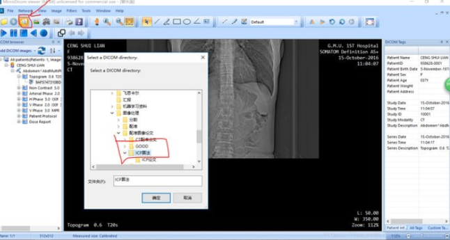 MicroDicom viewer